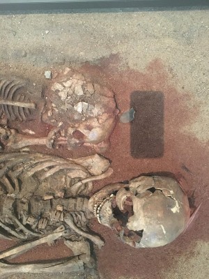 Figure 2: The Vedbæk woman’s injuries, National
